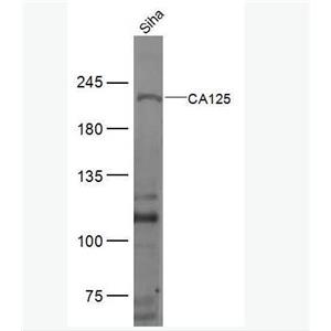 Anti-CA125 antibody-卵巢癌抗原抗体