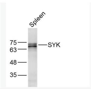 Anti-SYK antibody非受体型酪氨酸蛋白激酶抗体,SYK