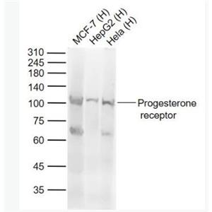 Anti-progesterone receptorantibody-孕激素受体抗体