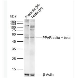 Anti-PPAR delta + beta  antibody-D型-過氧化酶活化增生受體抗體