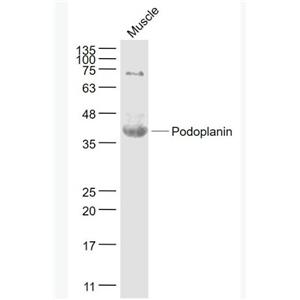 Anti-Podoplanin antibody-平足蛋白/淋巴管内皮细胞蛋白抗体