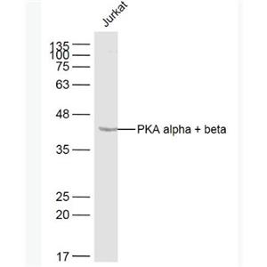 Anti-PKA alpha + beta antibody-蛋白激酶A抗体,PKA alpha + beta