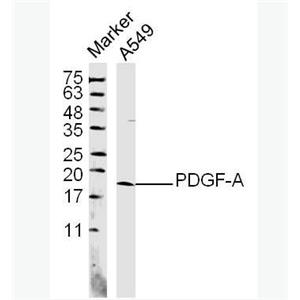 Anti-PDGF-A antibody-血小板源性生长因子A抗体