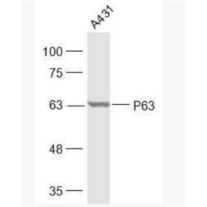 Anti-P63 antibody-肿瘤抑制基因p63α抗体