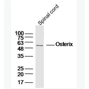 Anti-SP7/Osterix  antibody-成骨相关转录因子抗体,SP7/Osterix