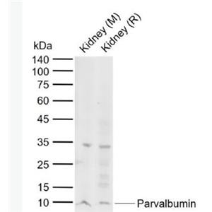 Anti-Parvalbumin antibody-细小清蛋白抗体