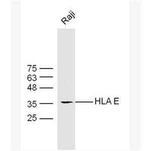 Anti-HLA E antibody-人类白细胞抗原E抗体