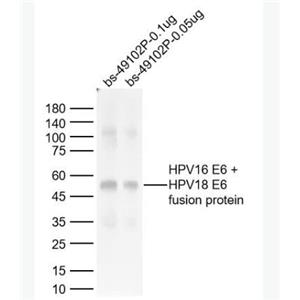 Anti-HPV16 E6 + HPV18 E6 antibody-人类乳头状瘤病毒16/18 E6抗体,HPV16 E6 + HPV18 E6