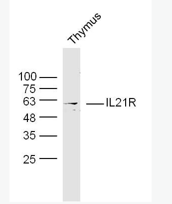 Anti-IL21R  antibody-白介素21受体抗体,IL21R