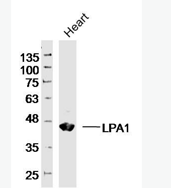 Anti-LPA1 antibody-溶血磷脂酸受体蛋白1/EDG2抗体,LPA1