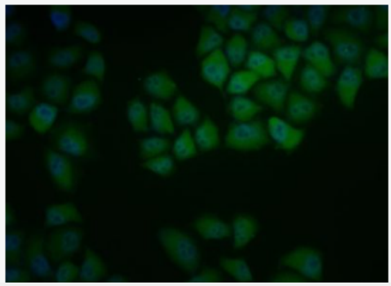 Anti-ID1  antibody-DNA结合抑制因子1抗体,ID1