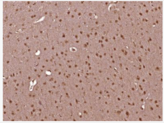 Anti-CRTC1 antibody-环腺苷酸应答元件结合蛋白转录共激活因子TORC1抗体,CRTC1