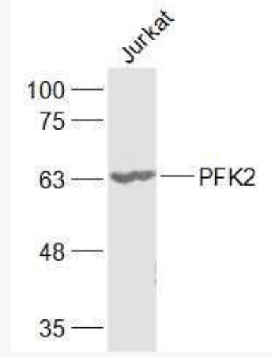 Anti-PFKFB3/PFK2 antibody-果糖-2,6-二磷酸酶3/磷酸果糖激酶2抗体,PFKFB3/PFK2