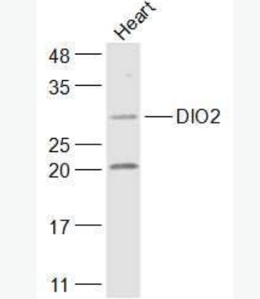 Anti-DIO2 antibody-脱碘酶2抗体,DIO2
