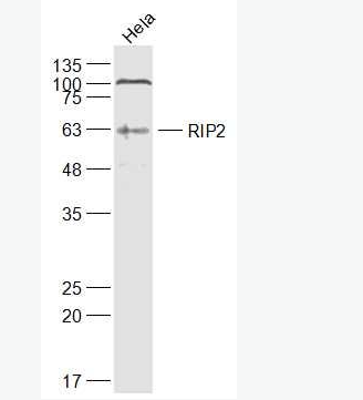Anti-RIP2  antibody-受体结合丝氨酸苏氨酸激酶2抗体,RIP2