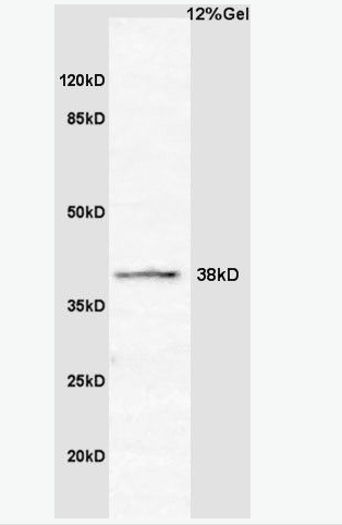 Anti-CCNG2 antibody-周期素G2抗体,CCNG2