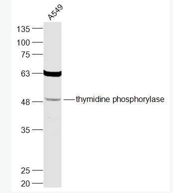 Anti-thymidine phosphorylase  antibody-胸苷磷酸化酶抗體,thymidine phosphorylase