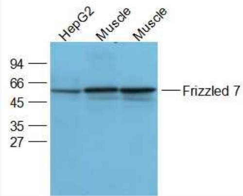 Anti-Frizzled   antibody-卷曲蛋白FZD7抗体,Frizzled