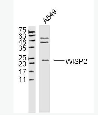 Anti-WISP2  antibody-Wnt1诱导信号通路蛋白2抗体,WISP2