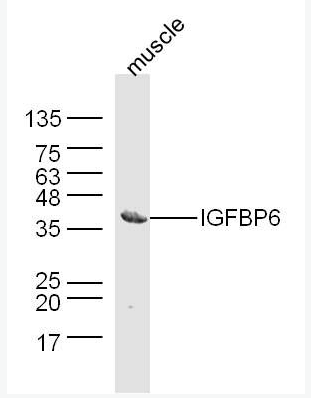 Anti-IGFBP6  antibody-胰島素樣生長因子結(jié)合蛋白6抗體,IGFBP6