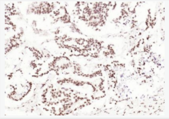 Anti-CDCA7 antibody-細(xì)胞分裂周期相關(guān)蛋白,CDCA7