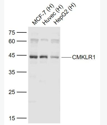 Anti-CMKLR1 antibody-趨化樣因子受體1抗體,CMKLR1