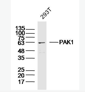 Anti-PAK1  antibody-p21激活激酶1抗体,PAK1