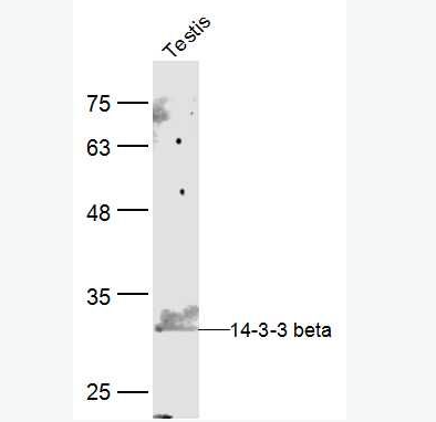 Anti-14-3-3 beta antibody-14-3-3β抗体,14-3-3 beta