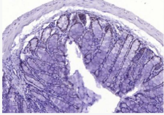 Anti-MYB antibody-转录激活因子MYB抗体,MYB