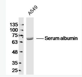 Anti-Albumin antibody-白蛋白抗体,Albumin