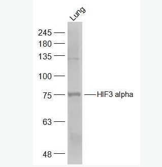 Anti-HIF3 alpha  antibody-缺氧诱导因子3α/HIF-3α抗体,HIF3 alpha