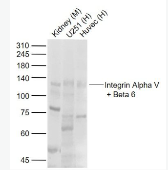 Anti-Integrin Alpha V + Beta 6 antibody-整合素αVβ6抗体,Integrin Alpha V + Beta 6