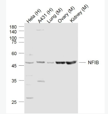 Anti-NFIB  antibody-核因子1B抗体,NFIB