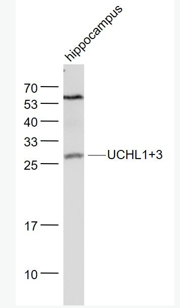 Anti-UCHL1+3 antibody-泛素硫酯酶L1+3抗体,UCHL1+3