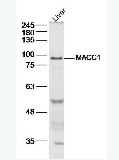 Anti-MACC1  antibody-结肠癌转移相关蛋白1抗体,MACC1