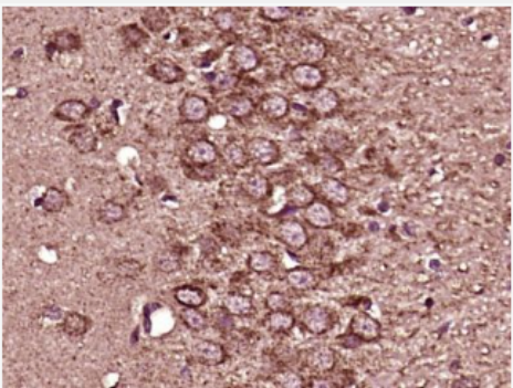 Anti-Zic1 antibody-锌指蛋白201抗体,Zic1