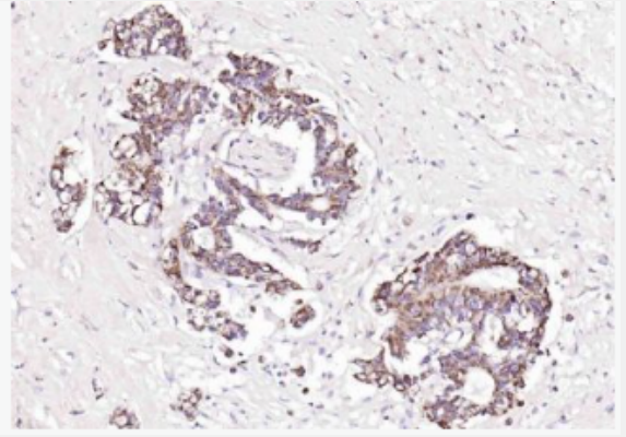 Anti-PAI1  antibody-内皮细胞纤溶酶原激活抑制蛋白1抗体,PAI1