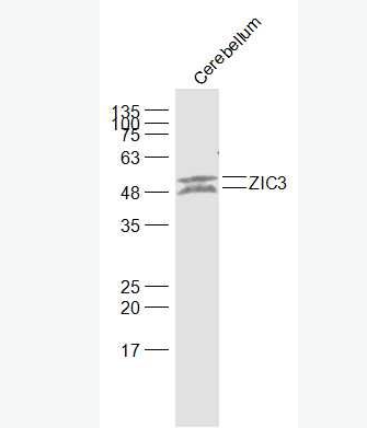 Anti-ZIC3 antibody-內(nèi)臟異位相關(guān)蛋白/鋅指蛋白203抗體,ZIC3