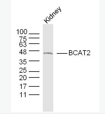 Anti-BCAT2 antibody-支鏈氨基酸轉(zhuǎn)氨酶2抗體,BCAT2