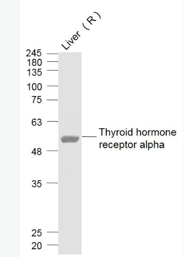 Anti-Thyroid hormone receptor alpha  antibody-甲狀腺激素受體α抗體,Thyroid hormone receptor alpha