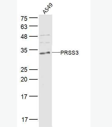 Anti-PRSS3 antibody-脑胰蛋白酶3抗体,PRSS3