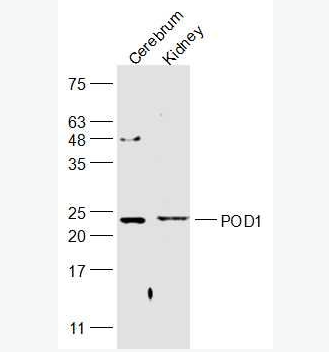 Anti-POD1 antibody-足细胞表达蛋白/转录因子21抗体,POD1