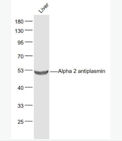 Anti-Alpha 2 antiplasmin antibody-α2纤溶酶色素上皮衍生因子抗体,Alpha 2 antiplasmin