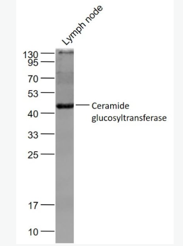 Anti-Ceramide glucosyltransferase  antibody-葡萄糖神经酰胺合成酶抗体,Ceramide glucosyltransferase