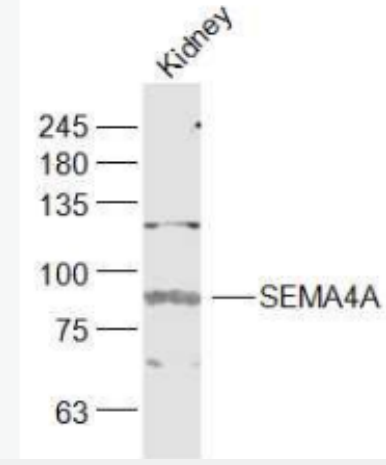 Anti-SEMA4A antibody-跨膜蛋白SEMA4A抗體,SEMA4A