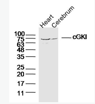 Anti-cGKI antibody-cGMP依賴性蛋白激酶1抗體,cGKI