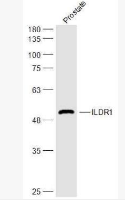 Anti-ILDR1 antibody-免疫球蛋白样结构域受体1抗体,ILDR1