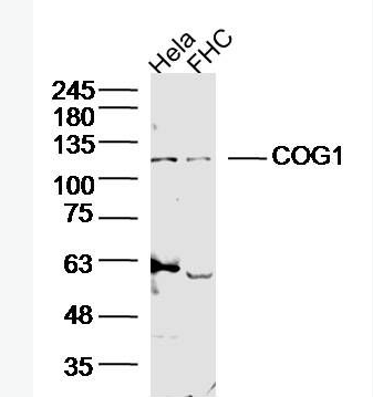 Anti-COG1 antibody-COG1蛋白抗体,COG1