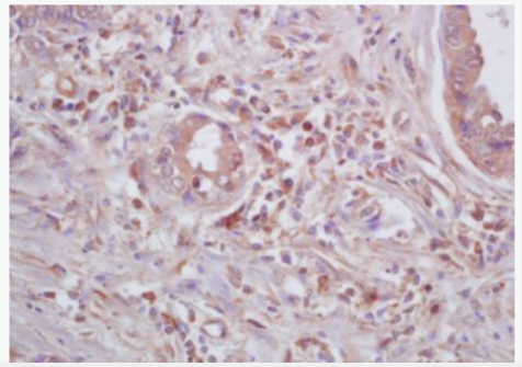 Anti-Beta galactosidase antibody-β半乳糖苷酶抗體,Beta galactosidase