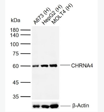 Anti-CHRNA4 antibody-烟碱型乙酰胆碱受体α4抗体,CHRNA4